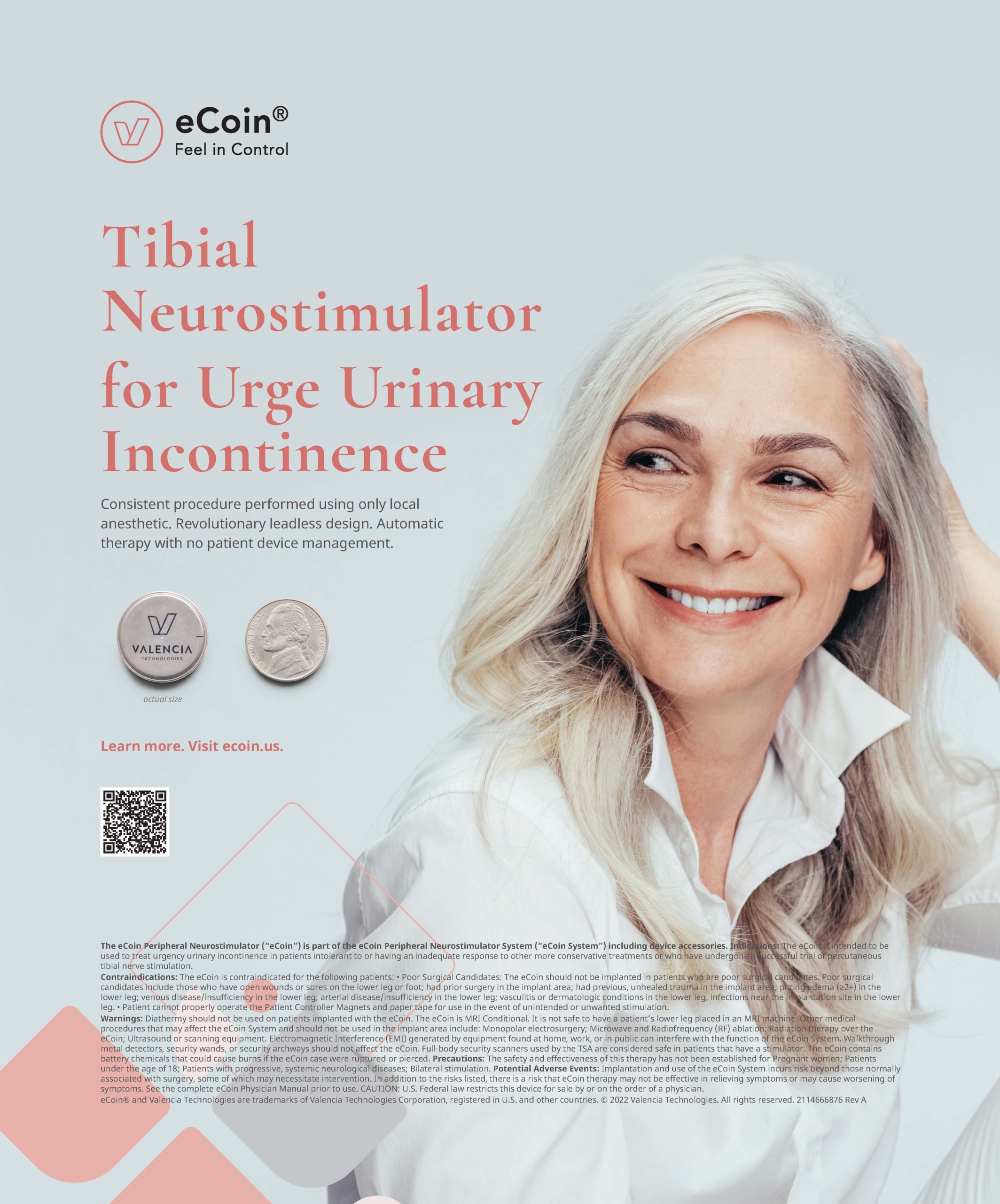 eCoin tibial neurostimulator for UUI